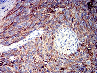 Monoclonal Mouse anti-Human ALCAM / CD166 Antibody (clone 3D9F1, IHC, WB)