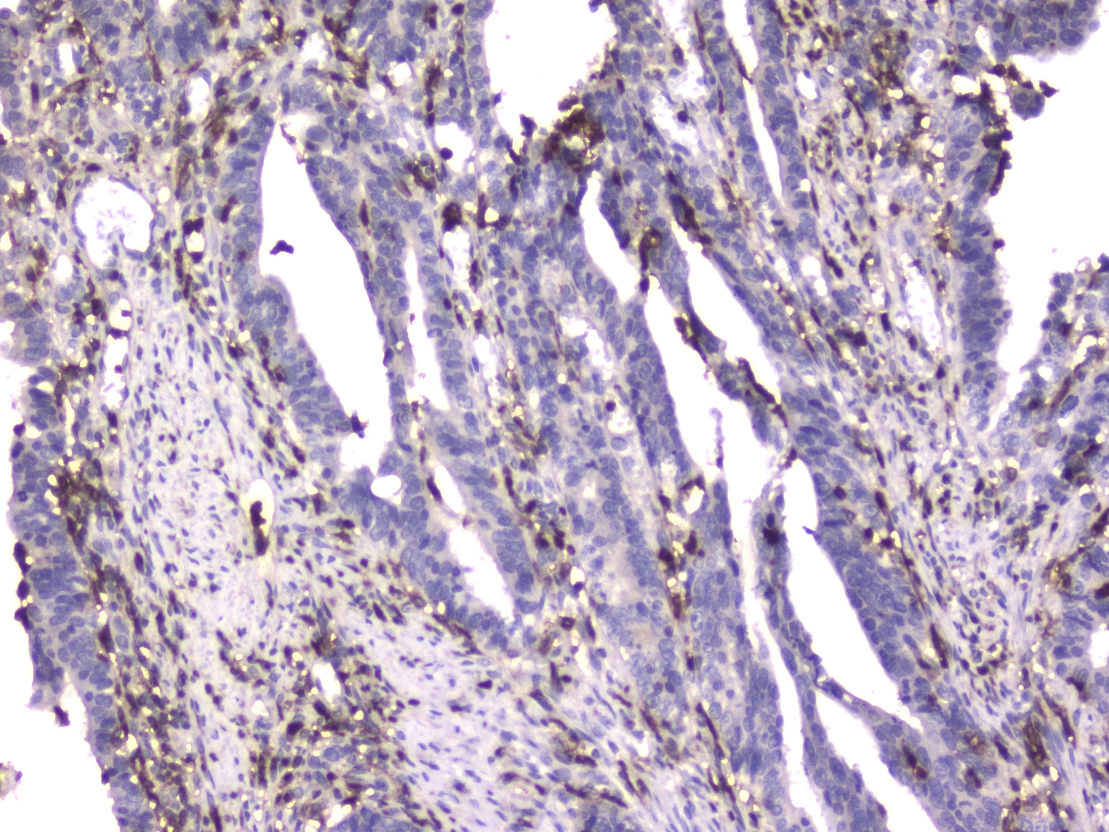 Monoclonal Mouse anti-Human ITGB2 / CD18 Antibody (IHC, WB)