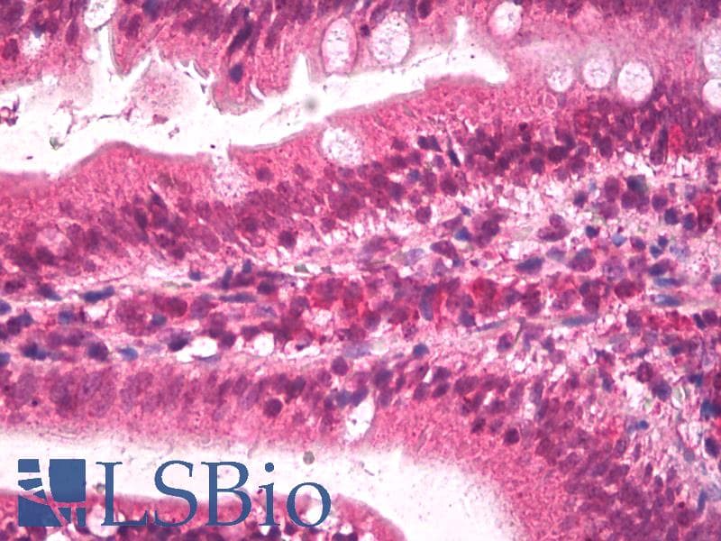 IHC-plus™ APOB / Apolipoprotein B Antibody (aa3984-3995)