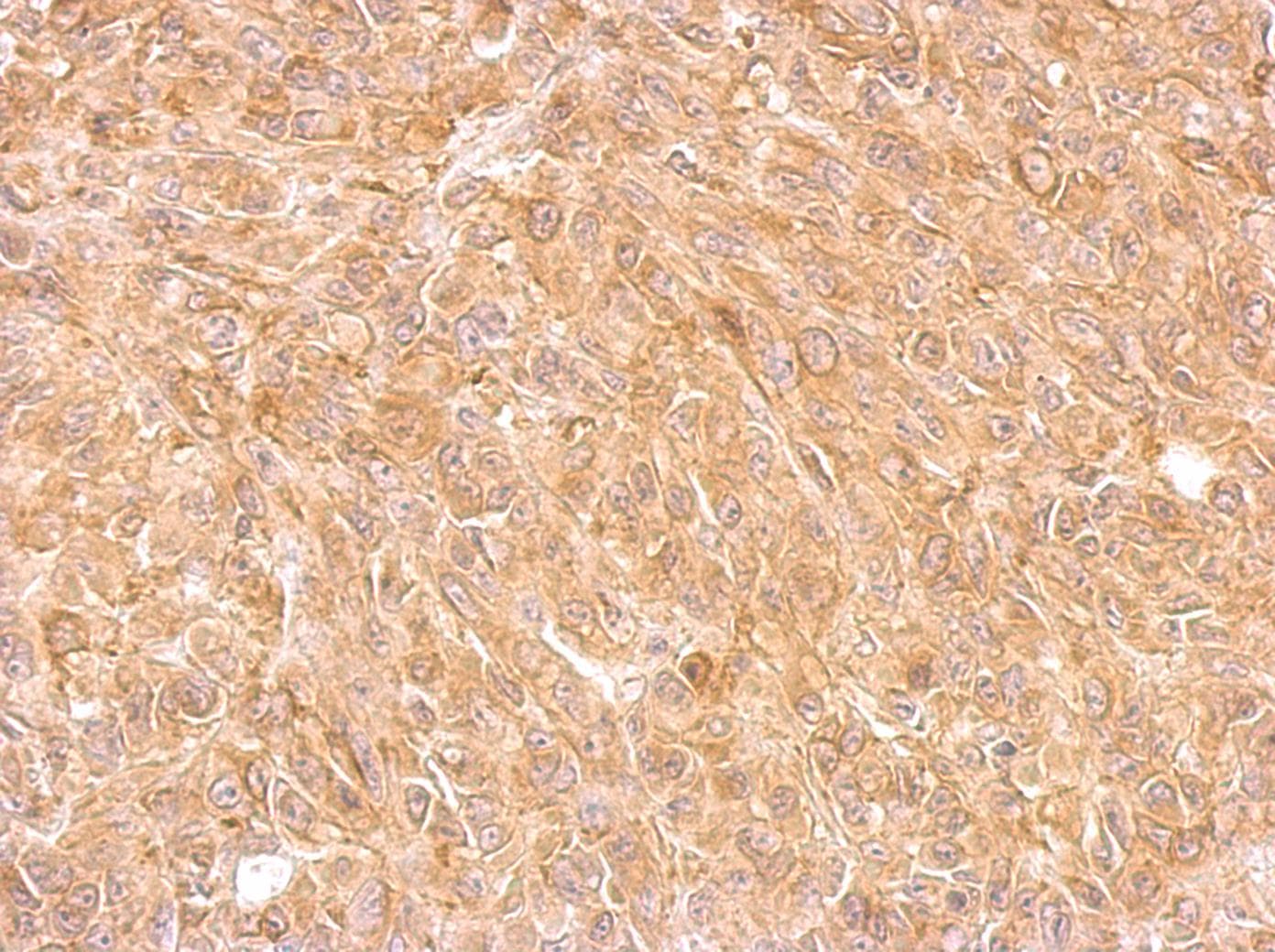AKR7A2 / AFAR Antibody (aa84-359)