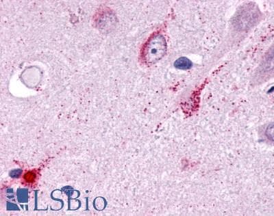 PathPlus™ TAAR1 / TA1 Antibody (Cytoplasmic Domain)