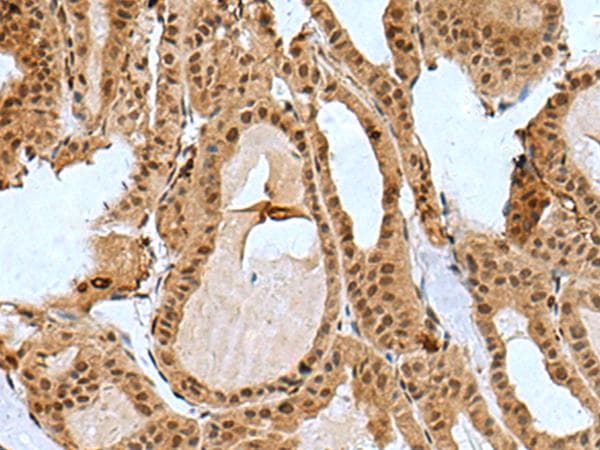 BCL7B Antibody