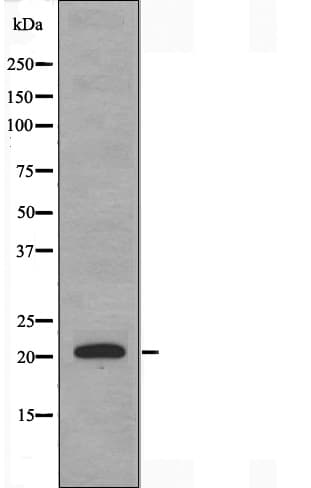 Polyclonal Rabbit anti-Human MRPL12 Antibody (IF, WB)