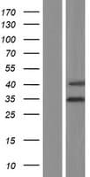 RSPH9 / C6orf206 Protein (Over-Expression Lysate Myc-DDK (Flag))