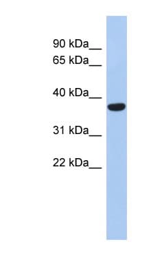 PPAPDC2 Antibody (N-Terminus)