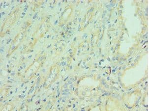 NAMPT / Visfatin Antibody (aa1-280)