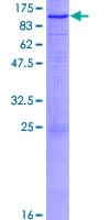 Human TRPC4AP / TRUSS Protein (Recombinant GST)