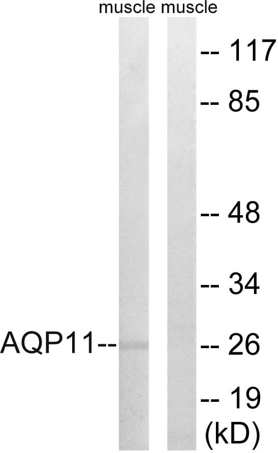 AQP11 / Aquaporin 11 Antibody