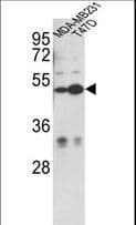 Polyclonal Rabbit anti-Human CEP55 Antibody (aa38-64, WB)