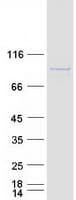 Human CCDC82 Protein (Recombinant Myc-DDK (Flag))
