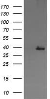 MAP2K3 / MEK3 / MKK3 Antibody (clone OTI5C9)