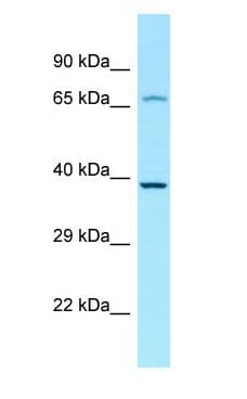 Polyclonal Rabbit anti-Human LPAR4 / GPR23 Antibody (C-Terminus, WB)