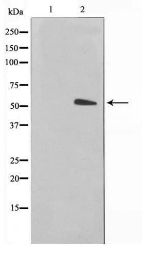 KRT15 / CK15 / Cytokeratin 15 Antibody