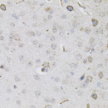 CEACAM5 / CD66e Antibody