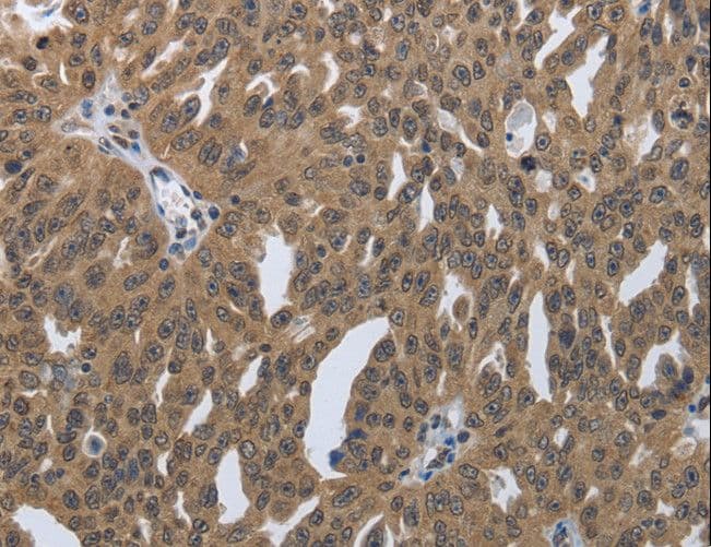 PRKAR1B Antibody
