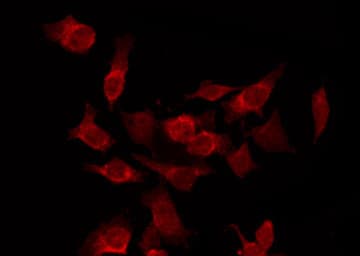 Polyclonal Rabbit anti-Human CDK15 / ALS2CR7 Antibody (IF, WB)