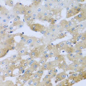Polyclonal Rabbit anti-Human AP1M2 Antibody (IHC, WB)