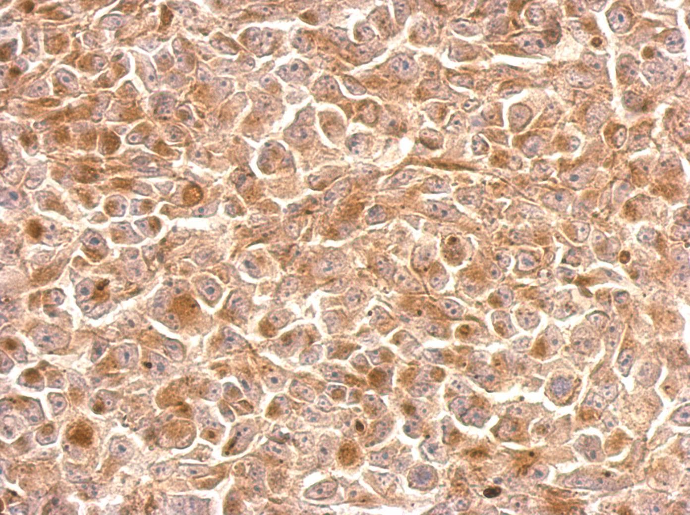 KLRC1 / NKG2A / CD159a Antibody (aa1-45)