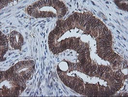 Monoclonal Mouse anti-Human CMPK / CMPK1 Antibody (clone OTI2B2, IHC, IF, WB)