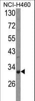 COMTD1 Antibody (aa218-246)