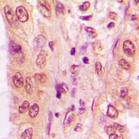 NFATC4 / NFAT3 Antibody (C-Terminus)