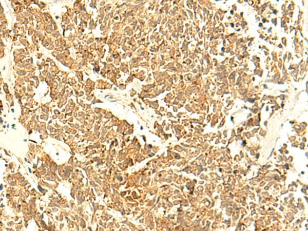 UNKL Antibody