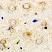 RPS14 / Ribosomal Protein S14 Antibody