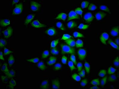 CACNA1C / Cav1.2 Antibody