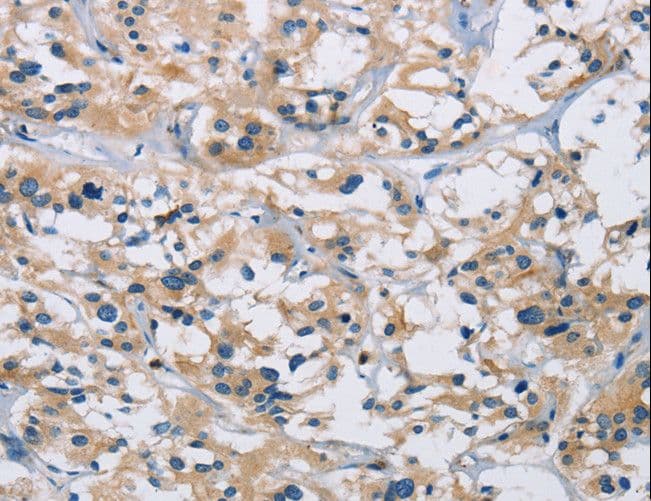 IHC-plus™ IL17RB Antibody