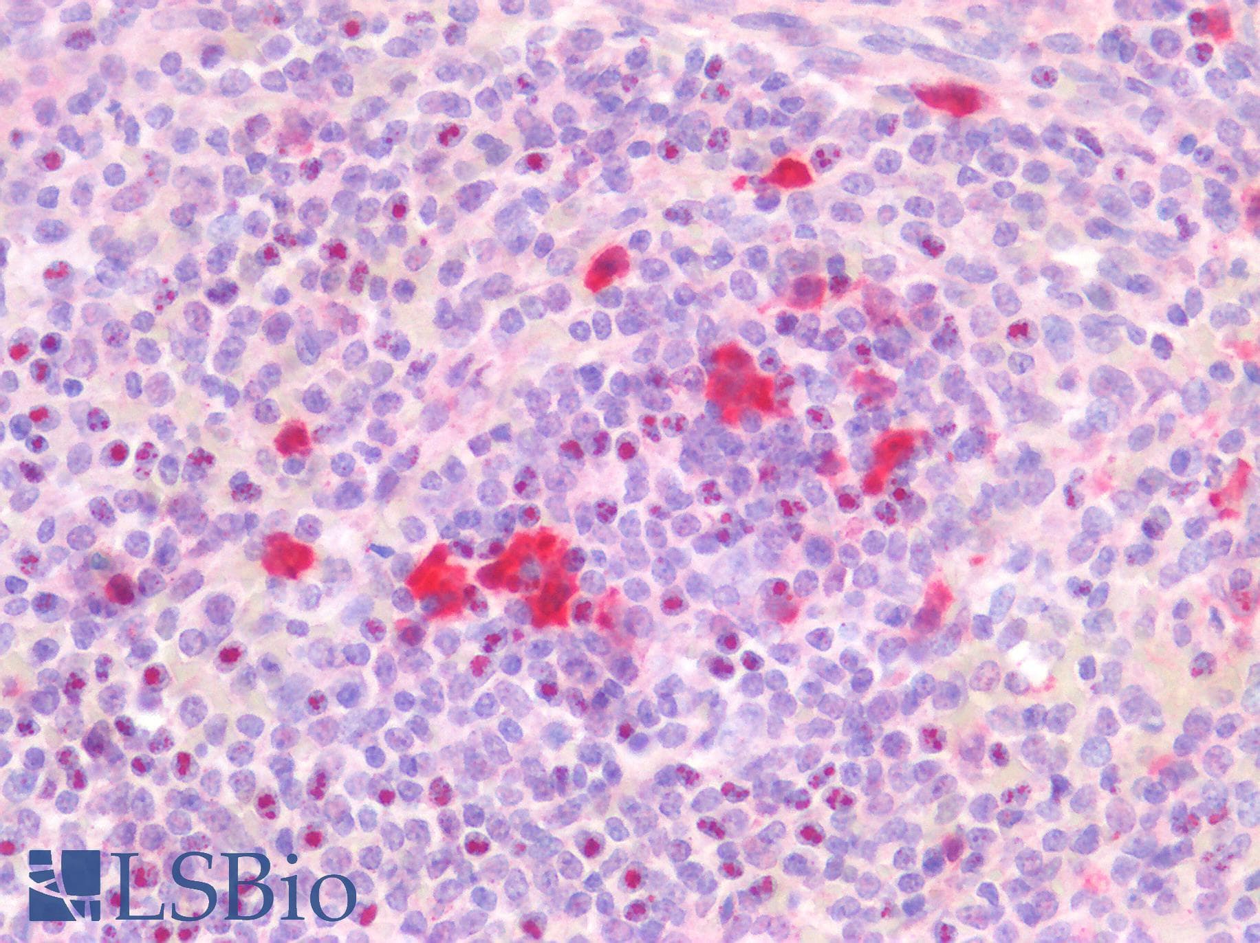 IHC-plus™ TS / Thymidylate Synthase Antibody (clone OTI2C3)