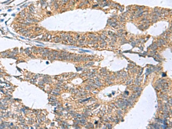 Polyclonal Rabbit anti-Human HPCAL1 / Hippocalcin-Like 1 Antibody (IHC, WB)