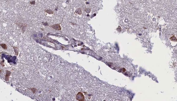 ACVR1C / ALK7 Antibody