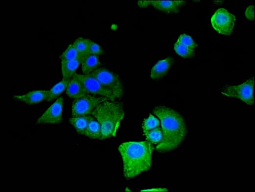 IFIT1 / ISG56 Antibody
