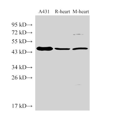 SERPINB2 / PAI-2 Antibody
