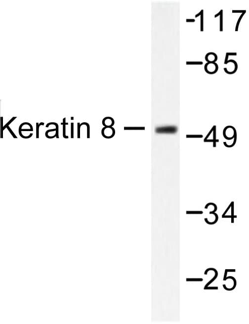 KRT8 / CK8 / Cytokeratin 8 Antibody (Val67)