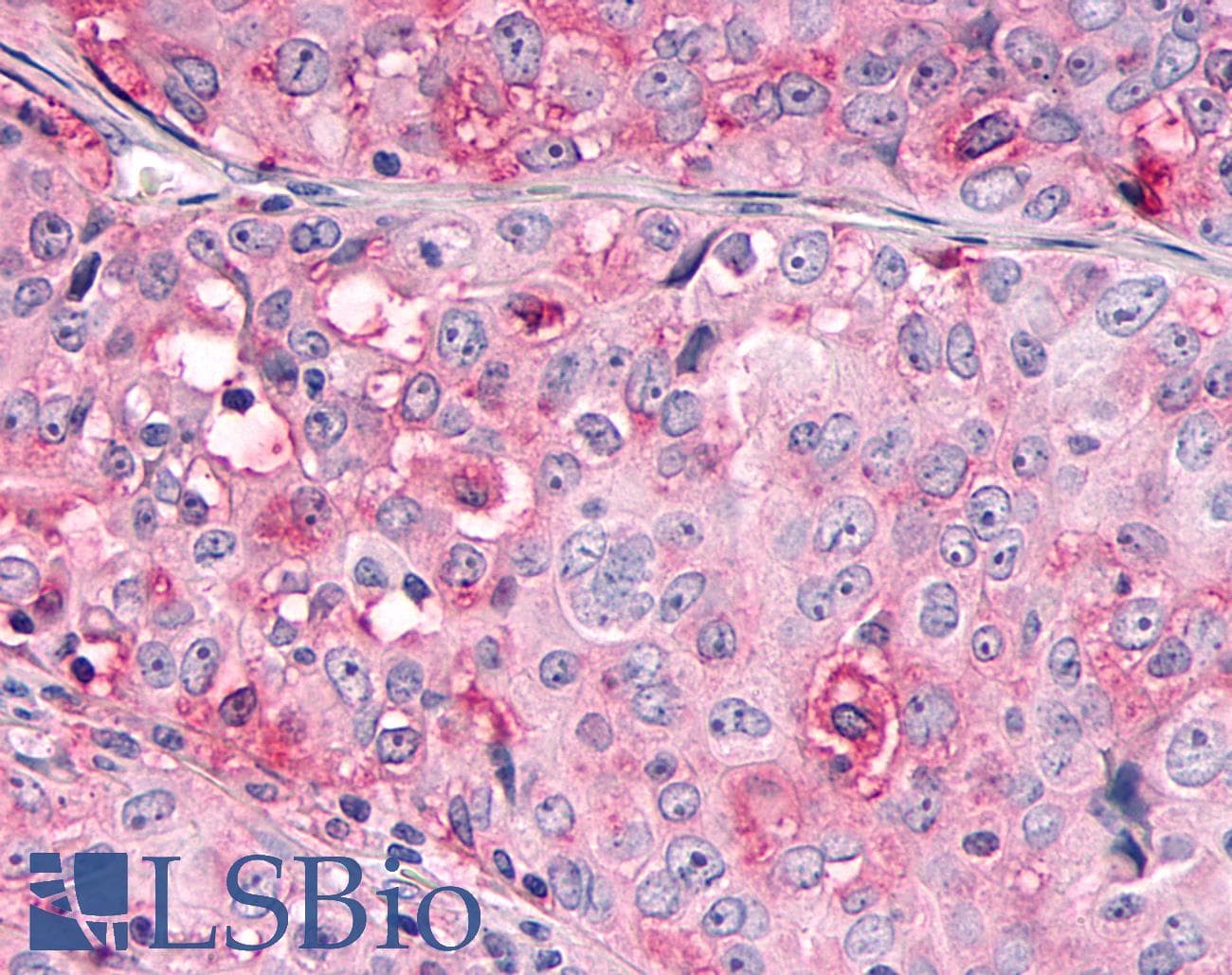 PathPlus™ OR10R2 Antibody (Extracellular Domain)