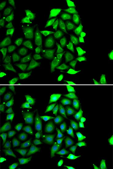 IKZF3 / AIOLOS Antibody