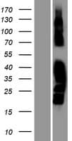 MAST4 Protein (Over-Expression Lysate Myc-DDK (Flag))