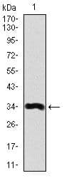 LPA / Lipoprotein a Antibody (Amino Acid: 4330-4521, clone 4H1)
