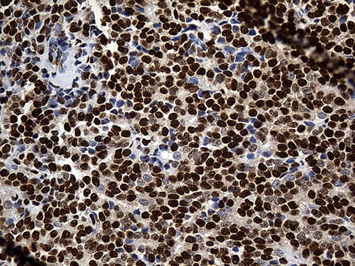 Monoclonal Mouse anti-Human PTBP3 / ROD1 Antibody (clone OTI5G7, aa300-552, IHC, WB)