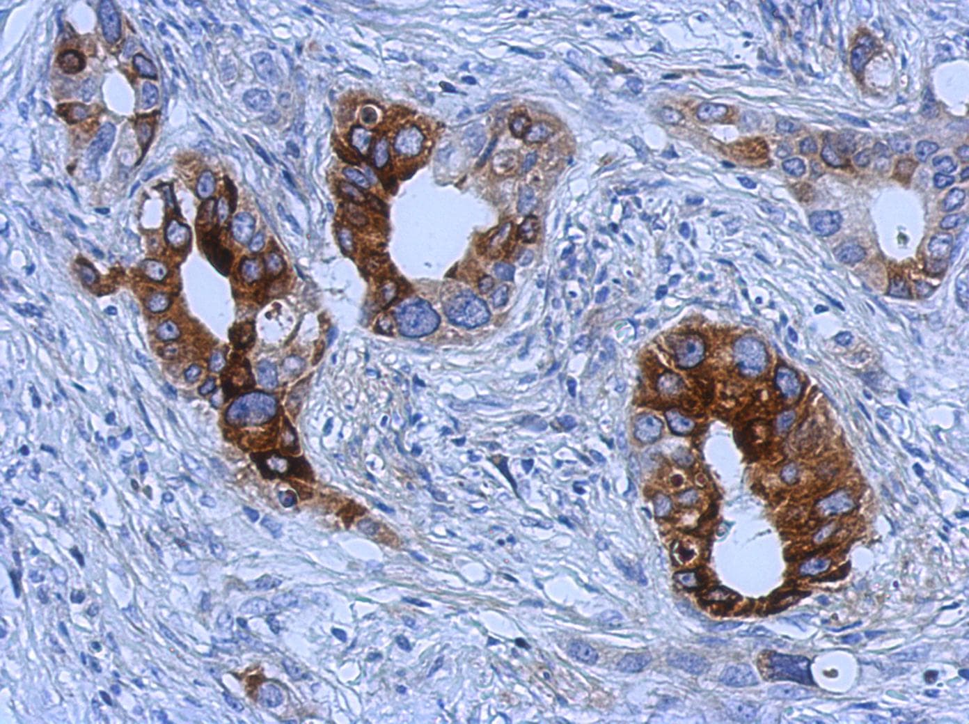 TFF1 / pS2 Antibody