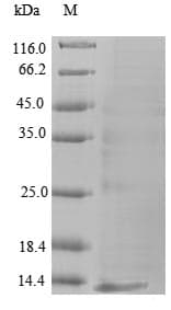 Apomastus schlingeri Oxalate oxidase 1- Hordeum vulgare (Barley) Protein (Recombinant 6His, N-terminus)
