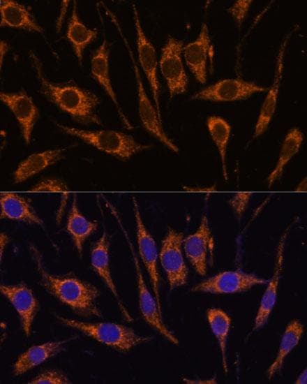 CCDC6 Antibody