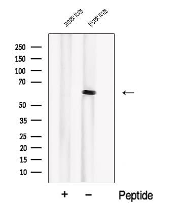 Polyclonal Rabbit anti-Human PIP5K1B Antibody (WB)