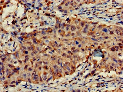 FAM107A / TU3A Antibody