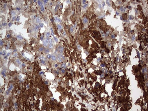 Monoclonal Mouse anti-Human MTDH / Metadherin Antibody (clone OTI2H4, aa70-582, IHC, WB)