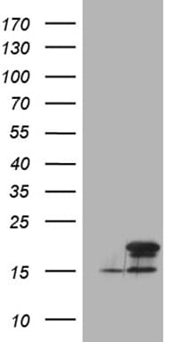 p16INK4a / CDKN2A Antibody (clone OTI11E9)