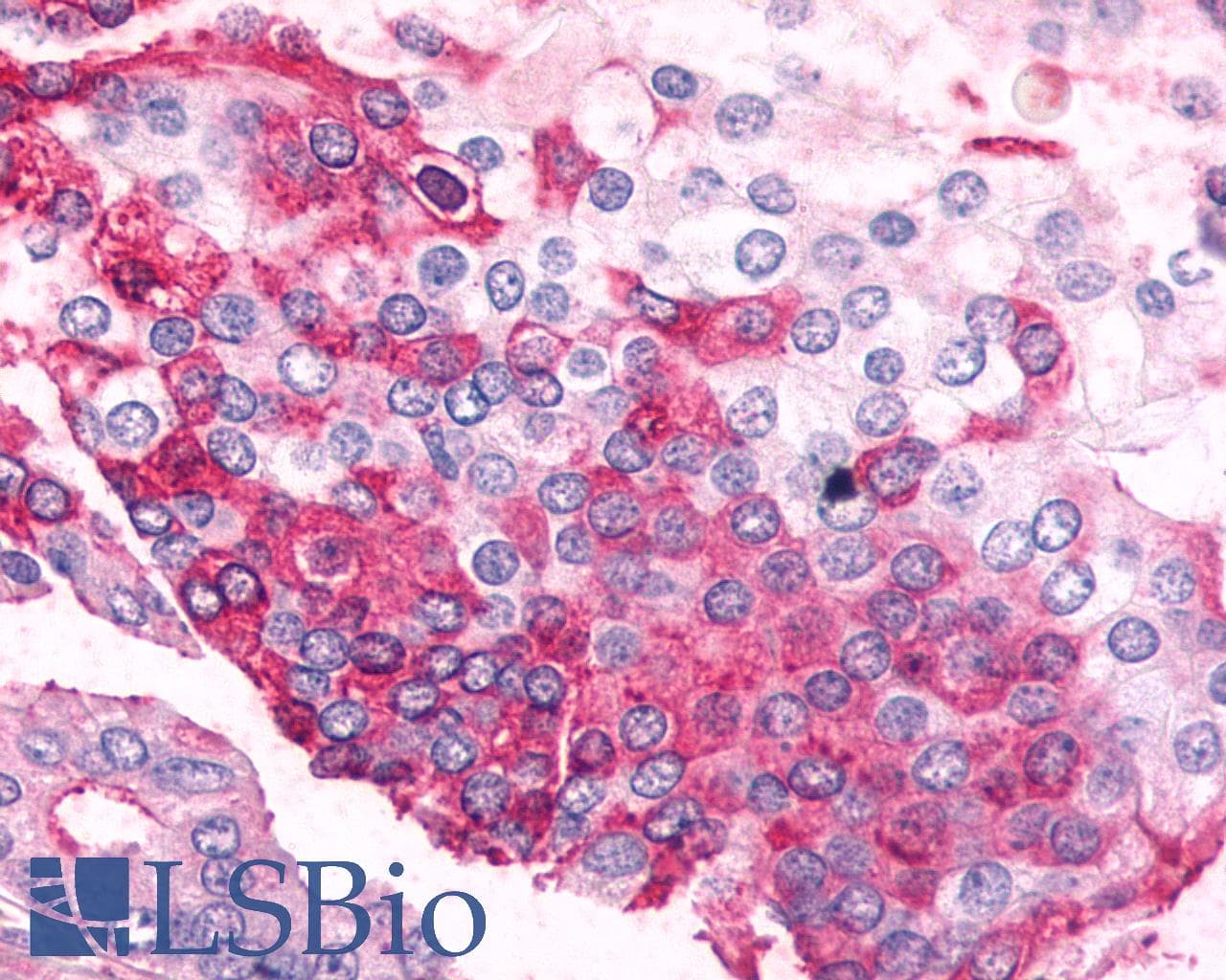 PathPlus™ ADRA2C Antibody (Extracellular Domain)