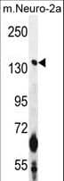 CAMSAP1 Antibody (aa34-62)