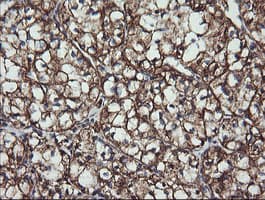 ACAA2 Antibody (clone OTI1B1)